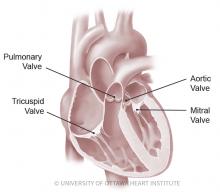 heart, heart defect, heart disease, congenital heart disease, congenital heart defect, OHS, #ohs, CHD, #CHD, heart health, education, CHD advocacy, CHD education, CHD awareness, heart disease